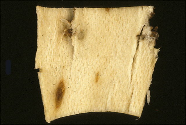 Bacterial wilt