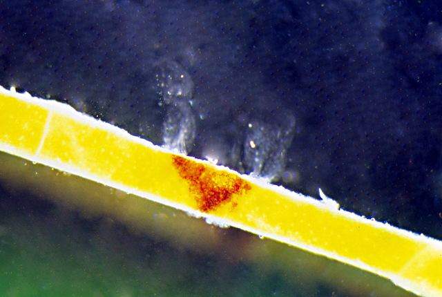 Bacterial blight (Brown stem)