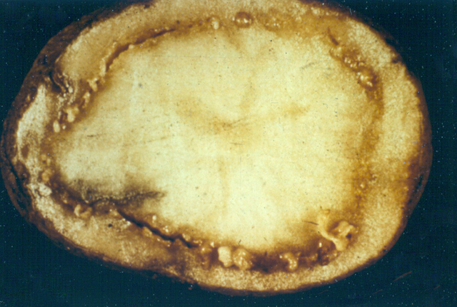 Bacterial ring rot
