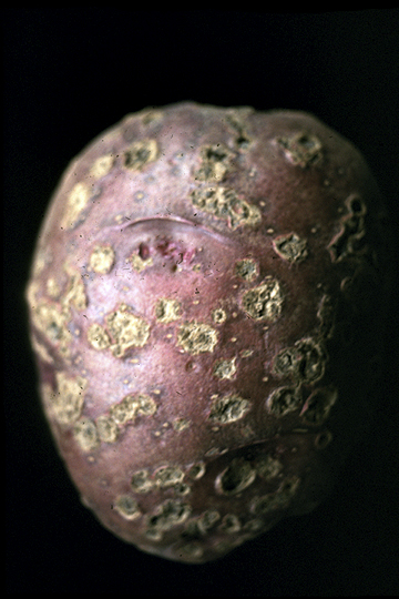 Common scab (Potato scab)